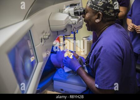 FORT BELVOIR, Va. (16 marzo 2017) La rifrazione Warfighter chirurgia oculare Programma e centro di ricerca presso l'Ospedale di Belvoir esegue la prima piccola incisione lenticule estrazione (sorriso) procedura del DoD, il più recente progresso nella chirurgia dell'occhio del laser. Per il sorriso, la chirurgia refrattiva research team qui è l'esercito del braccio di una pietra miliare, tri-service ricerca la collaborazione tra esercito, marina, aviazione e Carl Zeiss Meditec. La procedura utilizza un molto veloce, corto-laser pulsato per eseguire la correzione di visione procedura e come risultato, visual il tempo di recupero è accelerata. Foto Stock