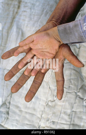 Sei famiglia dito, ragazzo mano su man mano palm, funzioni fotografiche, India Foto Stock