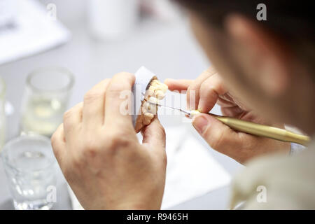 Odontotecnico lavorando su un dentista di colata. Mano di odontotecnico lavora con acrilici per la modellazione di denti Foto Stock