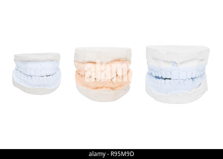 Dental calchi dal gesso. Isolato su sfondo bianco. Foto Stock
