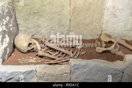 Un vero uomo scheletro giacente a terra Foto Stock