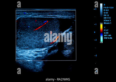 Immagine colorata dei moderni monitor ad ultrasuoni. Ecografia macchina. Alta tecnologia medica e attrezzature sanitarie. Imaging a ultrasuoni o sonogra Foto Stock