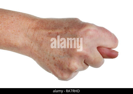 Segno di fico formano la nonna - pugno con il pollice, incastrato tra l'indice e il Medio in segno di disprezzo e di scherno. Isolato su bianco studio macro Foto Stock