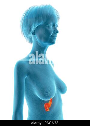 Illustrazione di una vecchia donna di pancreas. Foto Stock