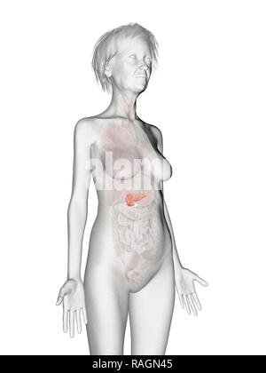 Illustrazione di una vecchia donna di pancreas. Foto Stock