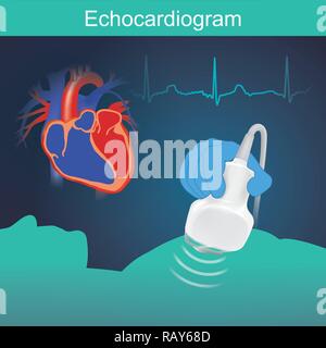 Esame di cuore con suono ad alta frequenza delle forme d'onda molto utile per valutare la funzione del cuore, compresi altri sintomi. Illustrazione Vettoriale
