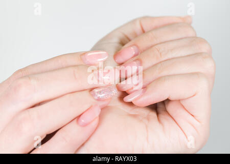 Primo piano della femmina di due mani bianche con il vecchio gel manicure lucidato necessitano di correzione dopo diverse settimane di usura. Verticale fotografia a colori. Foto Stock