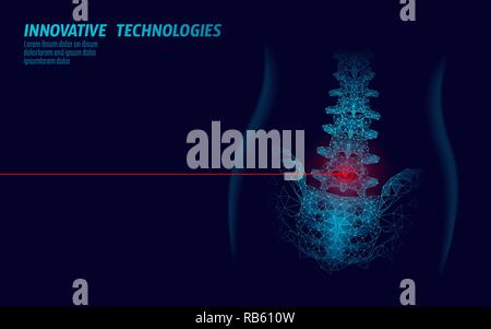 Fisioterapia Laser colonna vertebrale umana. Area di dolore intervento chirurgico medicina moderna tecnologia bassa poli triangoli 3D render femmina ernia posteriore illustrazione vettoriale Illustrazione Vettoriale