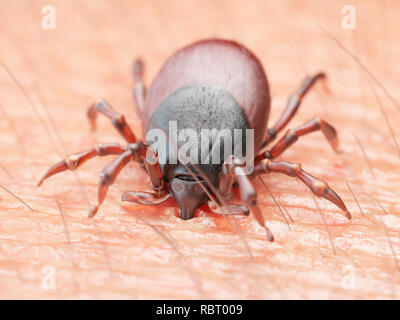 Illustrazione di un tick mordere la pelle umana. Foto Stock