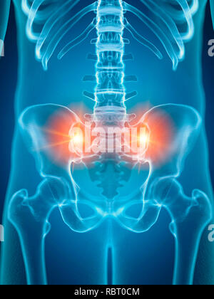 Illustrazione di una penosa sacrum giunti. Foto Stock