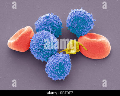 Le cellule del sangue. Color scanning electron microfotografia (SEM) umana di globuli rossi (eritrociti, rosso), cellule bianche del sangue (leucociti, blu) e piastra Foto Stock