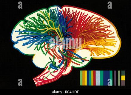 Il cervello. Le fibre nervose nel cervello che sono coinvolti nell'analisi della memoria di sensazioni e di pensare. Disegno. Colore. Foto Stock