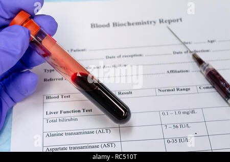 Raccolta di sangue per analisi biochimiche del sangue per malattie metaboliche Foto Stock