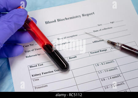Raccolta di sangue per analisi biochimiche del sangue per malattie metaboliche Foto Stock