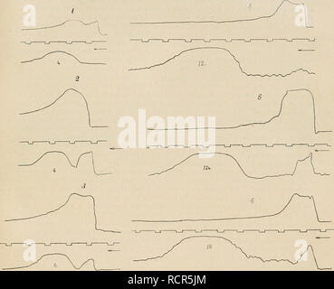 . Dictionnaire de physiologie. Fisiologia. La deglutizione. 731 il fut possibile de dÃ©terminer l'intervalle de temps Ã©coulÃ© entre la compressione des deux ballons, en d'autres termes, la durÃ©e de la trasmissione de la contrazione jusqu'à l'endroit considÃ©rÃ© de l'Åsophage. Dans chacun des raddoppia tracÃ©s(i-6) fig.88, onreconnaÃ®tladiffÃ©rencedesmouvements pharyngien et Åsophagien; la courbe supÃ©rieure provient du ballon pharyngien, l'infÃ©- rieure du ballon Åsophagien. Les chilTres inscrits sur cette derniÃ¨re indiquent la distanza TracÃ©s douhles inscrits au moyen de deux ballons.. Fig. 88. Â Foto Stock