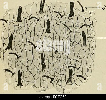 . Lo sviluppo del corpo umano : un manuale di embriologia umana. Embriologia; embrione, Non-Mammalian. 148 sviluppo delle ghiandole SUDORIPAROUS h per cui esso si stacca dai capelli e la sostituzione di capelli deriva da una papilla che probabilmente è spuntato fuori da quello più vecchio prima della sua degenerazione e porta con sé un cappuccio di cellule epidermiche. Non è chiaro se i casi di eccessivo sviluppo di capelli sopra il viso e la parte superiore del corpo che si verificano occasionalmente sono dovute ad un eccessivo sviluppo delle successive dei follicoli piliferi (ipertricosi) o ad una persistenza e continu Foto Stock