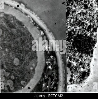 . Sviluppo di metodi cytochemical per lo studio della parete ascospore biogenesis e maturazione. Ascomycetes; delle ascospore; funghi. . Si prega di notare che queste immagini vengono estratte dalla pagina sottoposta a scansione di immagini che possono essere state migliorate digitalmente per la leggibilità - Colorazione e aspetto di queste illustrazioni potrebbero non perfettamente assomigliano al lavoro originale. Lusk, Demaris E.. Foto Stock