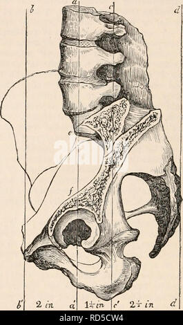 . Il encyclopaedia - Wikizionario di anatomia e fisiologia. Anatomia e fisiologia; Zoologia. Bacino. arco sacrale, ma resiste al loro spostamento verso l'interno, che risulterebbe dalla pressione dei femori in direzione del collo di queste ossa. Per effetto di questa pressione, quando la resa pnbes, è mostrato in de- formity che è stato definito il bacino rostrata, risultante dalla frantumazione di queste ossa insieme. Il Cot3'lo-arco pubico riceve anche nella sua concavità, parte del peso dei visceri addominali, però, dall'attacco di questi per la colonna vertebrale, loro capo peso si concentra Foto Stock