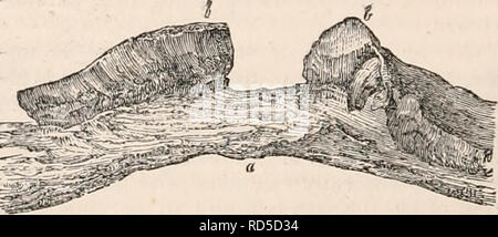 . Il encyclopaedia - Wikizionario di anatomia e fisiologia. Anatomia e fisiologia; Zoologia. 134- PRODOTTI, ACCIDENTALE. corticali, subire rammollimento e la rarefazione, anil vengono gradualmente estesa in una forma globulare sac. Nuovo di materia ossea viene generata anche fuori, aiuto- ing per completare la capsula, che è anche con questo tipo di assistenza, comunemente imperfetta. Quando viene sviluppato in ossa di molto la consistenza spugnosa, la perforazione può essere, secondo Muller, si verificano invece di espansione; riteniamo che, almeno in alcuni casi la crescita proviene dal sub-periosteale membrana cellulare. In questa ultima varietà la forma è meno regularl Foto Stock