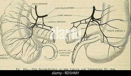 . Cunningham il libro di testo di anatomia. Anatomia. 1216 il sistema digestivo. è stato trovato in quasi ogni possibile situazione in addome che la sua lunghezza e la misura della sua mesenterio consentirebbe di raggiungere. In ogni caso la tenia anteriore del cieco, che si è sempre distinto e offre la più sicura guida al processo vermiform, e la sua base può essere individuato con certezza seguendo questa tenia al retro del cieco (Fig. 954). La sua dimensione è quasi come variabile come la sua posizione. Facendo la media di numerose misurazioni, la sua lunghezza può essere dato come circa 3J pollici (92 mm., Berry), e Foto Stock