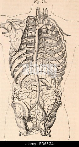 . Il encyclopaedia - Wikizionario di anatomia e fisiologia. Anatomia e fisiologia; Zoologia. 192 AORTA. terfere con la completa distensione della auricole. Gli aneurismi del tratto trasversale dell'aorta, quando rivolto in avanti, di solito il progetto presso il lato destro dello sterno circa il secondo spazio intercostale : quando il sacco si estende verso l'alto verso il collo, è frequentemente essere- proviene una questione di estrema difficoltà per dis tinguish un aneurisma dell'aorta da un aneurisma della innominata o qualche altro grande tronco arterioso nel quartiere; casi sono su record, dove la pressione di tali aneurismi dell'aorta Foto Stock