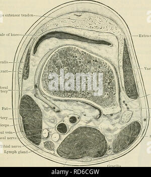 . Cunningham il libro di testo di anatomia. Anatomia. FOSSA poplitea. 1457 che si estende da un punto a metà strada tra la tuberosità sciatico e il trocantere maggiore al centro della fossa poplitea. Il nervo entra la coscia sotto la copertura del bordo laterale del bicipite, considerando che la parte posteriore del nervo cutaneo della coscia che assume la stessa linea, superficiale scende al bicipite, tra di esso e la fascia lata. Nella operazione di stiramento del nervo sciatico è tagliato immediatamente distale rispetto al bordo inferiore della gluteeus maximus. Il chirurgo, in piedi sul lato del paziente Foto Stock