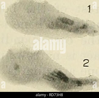 . Cunningham il libro di testo di anatomia. Anatomia. La tuberosità scanalatura per perox^eus longus una scanalatura per peron.-eus tuberosità longus il suo centro e in prossimità del suo bordo dorsale. Questo è per l'articolazione con il lato laterale del terzo cuneiforme ; prossimale e distale rispetto a questa superficie è ruvida per legamenti. Non di rado, prossimale alla faccetta per il terzo cuneiforme, vi è una piccola superficie articolare per la navicular, come avviene normalmente in il gorilla, mentre in direzione prossimale e sull'aspetto plantare la sporgente in- ferior angolo è talvolta pro- fornito con un aspetto su cui la testa della T Foto Stock