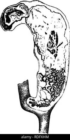 . La patologia e la diagnosi differenziale di malattie infettive degli animali : preparata per studenti e professionisti del settore della medicina veterinaria . Medicina veterinaria; malattie trasmissibili negli animali. Malattie infettive entero-epatite 321. Fig. 72. cieco malato che mostra l'ulcera- ated mucosa. Ed essi si legano agli altri il cieco o all'intestino o fissare alla parete addominale. In queste fasi, l'microparasite non è stata trovata. Sembra che abbia fatto il suo lavoro da distruggere la membrana mucosa e hanno lasciato il campo per i vari batteri. Altre porzioni del tratto digerente non sono affec Foto Stock