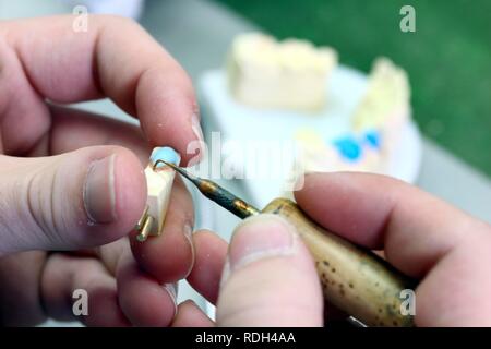 Laboratorio Odontotecnico, fabbricazione di protesi dentarie da parte di un maestro artigiano, modellazione al bordo di una corona con cera di precisione Foto Stock