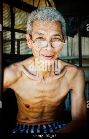 Luang Namta / Laos - Lug 06 2011: capo villaggio con gli occhiali in attesa del sole di mezzogiorno a scomparire Foto Stock