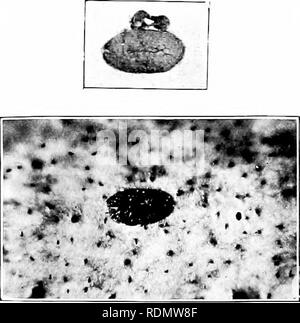 . Gli insetti ed altri parassiti alleate di Orchard, Bush e serra la frutta e la loro prevenzione e trattamento . Pesti di insetto; frutta. 228 pesti di insetto. liatched in tlie prima settimana in .Tudc, e ga-e lise per maturare le femmine in agosto, che depositato le uova che liatclied nel mese di settembre. La maggior parte di questi sono stati completamente sviluppati femmine liy tlu' xx di Octolier, e dalla e.sgs prevista l.iy questi ci molleggiante larva', whicli ho trovato anche sul Imshes in Xovendjer. Sembra pertanto tiiat nel Kent, e probabilmente altrove, vi possono Ije come molti come tre lu'doli di questo Coccid, ma c'è di solito Foto Stock
