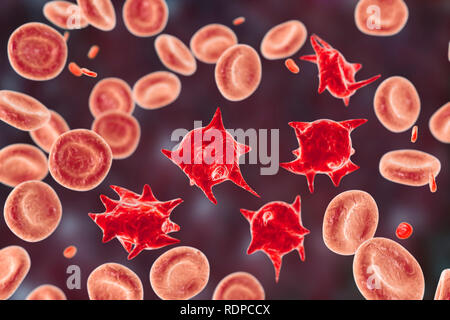 Acanthocytes. Illustrazione di una anormale cellule rosse del sangue noto come stimolare cellule o acanthocytes. Le cellule rosse del sangue con questo aspetto può verificarsi in associazione con una rara condizione chiamata abetalipoproteinemia, così come nelle malattie del fegato, Huntington acanthocytosis, ereditato diversi disturbi neurologici, anoressia nervosa, ipotiroidismo, alcolismo e altri disturbi. Le Cellule deformate sono distrutti prematuramente, principalmente nella milza, causando anemia. Foto Stock