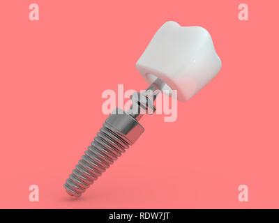 Impianto dentale dentista, dente formato, materie plastiche, uomo, trattamento dei denti 3D rendering Foto Stock