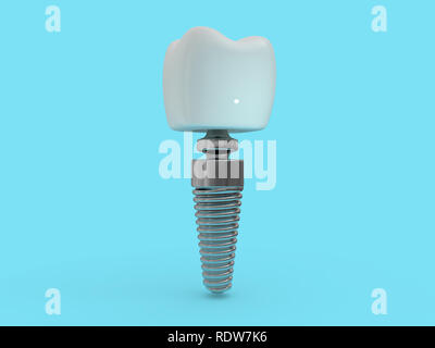Impianto dentale dentista, dente formato, materie plastiche, uomo, trattamento dei denti 3D rendering Foto Stock