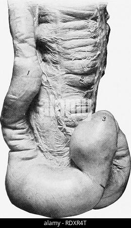 . L'anatomia di animali domestici . Anatomia Veterinaria. 428 SISTEMA DIGESTIVO DEL CAVALLO hanno un diametro di circa venti pollici (50 cm.)- Questo è riuscita da un imbuto- terminale a forma di contrazione. Il diritto parte ventrale del grande colon è attaccato alla curvatura meno accentuata del cieco da due strati del peritoneo che formano il caeco-coliche piega (Plica csecocolica). Il diritto le parti sono uniti dal peritoneo su entrambi i lati e anche da areolare tessuto e fibre muscolari, la superficie di contatto è di circa quattro o cinque pollici (ca. 10 a 12 cm.) ampia; le parti di sinistra sono allegate ad ogni altri Foto Stock