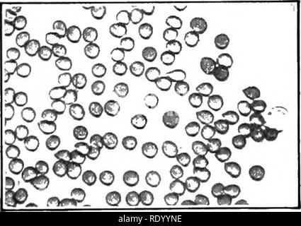 . Essentials di biologia ha presentato problemi. Biologia. Il sangue e la sua circolazione 367 per ogni 100 c.c. (Vedere il capitolo XXVII.) Alcuni prodotti di scarto, per essere parlato di più tardi, arco anche trovato nel plasma. La coagulazione del sangue. - Se in carni bovine fresche il sangue viene lasciata a riposo per una notte, si troverà ad avere separato in due parti, un colore rosso scuro, quasi solida Clot e un sottile, paglia-liquido colorato chiamato siero. Il siero è trovato essere composta di circa il 90 per cento di acqua, da 8 a 9 per cento proteid e dal 1 al 2 per cento di zuccheri, grassi e di sostanze minerali. In questi versi si molto assomiglia strettamente al fluido f Foto Stock