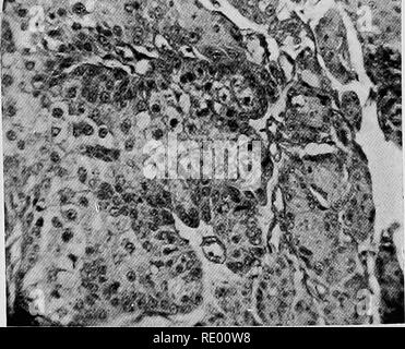 . Malattie chirurgica del cane e del gatto, con capitoli su anestesia e ostetricia (seconda edizione di "i cani ed i gatti chirurgia). Cani e gatti. 68 I Cani Ed I Gatti chirurgia diagnosi clinica può solo essere sospettata dal fatto che il tumore è dura al tatto, non è particolarmente ben definiti bordi su ogni lato ed è cresciuto molto rapidamente poiché il suo aumento di dimensioni è stato osservato per la prima volta. Il paziente, troppo, mostra segni di deperimento e crescite secondario può essere visibile in contigui di ghiandole linfatiche. Se la regione della bocca è interessato (come illustrato mediante la. Fig. 41.-La fotomicrografia di Foto Stock