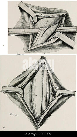 . Chirurgico e operazioni di ostetricia . Chirurgia veterinaria. . Si prega di notare che queste immagini vengono estratte dalla pagina sottoposta a scansione di immagini che possono essere state migliorate digitalmente per la leggibilità - Colorazione e aspetto di queste illustrazioni potrebbero non perfettamente assomigliano al lavoro originale. Williams, Walter lungo, 1856-1945; Pfeiffer, Wilhelm. Ithaca, N. Y. : W. L. Williams Foto Stock
