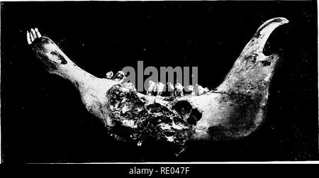 . Studi veterinari per studenti agricoli. Medicina veterinaria. ACTINOMYCOSIS. 119 attraverso la membrana della mucosa della bocca sul conto di dis- alleggerite denti; o attraverso alcune abrasioni della mucosa della bocca, gola o lo stomaco. Viene anche generalmente riconosciuto che il parassita è di solito presi in con il cibo. È possibile che questo parassita può vivere attraverso uno stadio del suo sviluppo o addirittura moltiplicare sulla superficie o nei tessuti di alcune delle più comuni piante di foraggio, in particolare orzo e segale. Un animale con un ascesso di scarico circa il capo sarebbe naturalmente infettare foo Foto Stock