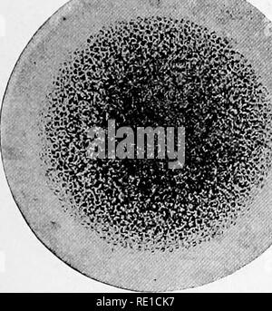 . Un libro di testo su batteri patogeni e protozoi per gli studenti di medicina e medici. Batteriologia; batteri patogeni; protozoi. Il Micrococcus Tetragenus 329 di diametro. In colture non mostrano la regolare disponi- mento in tetrads come costantemente come nel sangue e tessuti di animali, dove essi si verificano in gruppi di quattro circondato da un trasparente capsula gelatinosa. Colorazione.-La macchia di organismi ben mediante metodi ordinari e splendidamente da Gram il metodo mediante il quale possono essere meglio demon- strated in tessuti. Isolamento.-l'organismo può essere isolato mediante inoculazione di un bianco con il mouse Foto Stock