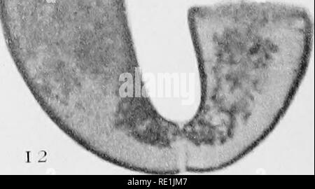 . Il Britannico Rhizopoda acqua dolce e Heliozoa. Rhizopoda; Heliozoa; animali d'acqua dolce. (.. Si prega di notare che queste immagini vengono estratte dalla pagina sottoposta a scansione di immagini che possono essere state migliorate digitalmente per la leggibilità - Colorazione e aspetto di queste illustrazioni potrebbero non perfettamente assomigliano al lavoro originale. In contanti, James, 1839-1909; di Hopkinson, Giovanni, 1844-1919. coautore; Wailes, George Herbert, 1862-. Londra, stampati per il Ray Scociety Foto Stock