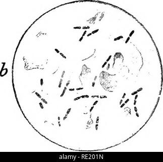 . Atlas e principi di batteriologia e libro di testo di speciali diagnosi batteriologica. Batteriologia. Fig. 16.-Bact. oegyptiacum (L. e N.). Fig. 17.-Bact. duplex (L. e N.) dall'occhio ; a volte si formano le catene brevi. Non- mobili, non si macchiano di grammo di metodo. Le culture assomigliare in ogni modo quelli dell'influenza bacillus ; la loro crescita è sempre poveri, migliori su terreno nutriente cosparso di sangue. Ottimale a 37°. Essi vivono solo un breve periodo di tempo-circa quattro giorni. Poco a tutti i patogeni. Si prega di notare che queste immagini vengono estratte dalla pagina sottoposta a scansione di immagini che possono essere state digitall Foto Stock