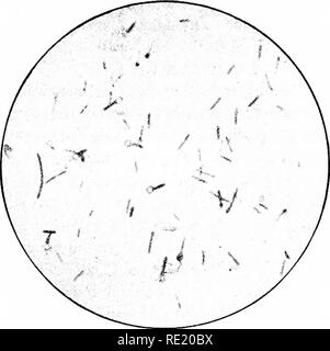 . Microrganismi e malattia. Un'introduzione allo studio di specifici microrganismi. Microrganismi. xv] BACILLI ANAEROBICA 381 degli esseri umani è probabilmente solo a causa della presenza di corpi estranei stessi (terra, spUnters, &amp;c.) che sono stati i veicoli del tetano bacilli; in organi interni non vi è alcun cambiamento definitivo. Negli organi non esistono bacilli presente, né è stato possibile produrre il tetano in altri animali inoculando loro con la corda, nervi, sangue o milza di animali morti di tetano. In conigli. Fig. 155.-simil.r esemplare come in figura rKECEDLG. X Foto Stock