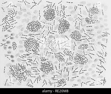 . Un libro di testo di batteriologia, compresa l'eziologia e la prevenzione delle malattie infettive e un breve resoconto di lieviti e muffe, haematazoa e psorosperms. Batteriologia. i'lgl. ri£? 2 Bacillus LEPR^. Si prega di notare che queste immagini vengono estratte dalla pagina sottoposta a scansione di immagini che possono essere state migliorate digitalmente per la leggibilità - Colorazione e aspetto di queste illustrazioni potrebbero non perfettamente assomigliano al lavoro originale. Crookshank, Edgar M. (Edgar marzo), 1858-1928. Philadelphia, W. B. Saunders Foto Stock