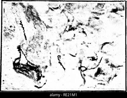 . Un libro di testo di batteriologia; un Trattato pratico per studenti e professionisti del settore della medicina. Batteriologia. 600 microorganismi patogeni Lavare in acqua, disidratare in classificato alcoli, e incorporare nella paraflBn con la usuale tecnica. Esaminato dopo il trattamento con uno di questi metodi, lo spiro- chsetes appaiono come nero, trasparente cadaveri principalmente extracellu- larly. Essi sono caratteristicamente ammassato circa i vasi sanguigni di organi e solo eccezionalmente sembrano penetrare all'interno di cellule di parenchima. Tentativi di coltivare Spirochaeta paUida furono in un primo momento non riuscito Foto Stock