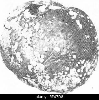 . Frutticoltura: pratici e scientifici, commerciali per i coltivatori di frutta e altri. Frutti-coltura. 120 l intera di un cluster può essere distrutto da infezioni derivanti in uno di essi. Alcune delle mele malate cadono a terra e rot lontano, ma altri rimangono sulla pianta e diventare gradualmente shrunken e stropicciata; in questo " mummie " con- dition rimangono fino a quando l'estate seguente, quando il fungo redevelops e infetta il nuovo raccolto. Su alcune varietà, ad esempio, James Grieve e di Lord Derby, la malattia si estende dall'interessato le mele per la fruttificazione sperone, e può anche causare la possibile Foto Stock
