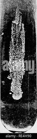 . Un libro di testo di batteriologia, compresa l'eziologia e la prevenzione delle malattie infettive e un breve resoconto di lieviti e muffe, haematazoa e psorosperms. Batteriologia. 184 MALATTIE INFETTIVE. coccus iu i tessuti e gli organi interni, e specialmente nel sangue- navi, in casi mortali di Sifilide congenita. Questi osservatori considerata la loro scoperta come avente un importante cuscinetto sull'eziologia della sifilide, ma Kolisko ha ricordato che è stato solo il risultato di infezione settica con presenza di Streptococcus pyogenes, come era già stato stabilito nella scarlattina. Cerebru-.yi'nal Foto Stock