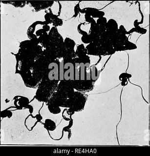. Un libro di testo di batteriologia, compresa l'eziologia e la prevenzione delle malattie infettive e un breve resoconto di lieviti e muffe, haematazoa e psorosperms. Batteriologia. 162 batteriologia. il microscopio quando è nell'asse lungo dell'apparecchiatura, in modo da apportare un hglit-combinazione stagna. L'apertura che viene riempito in una normale fotocamera dalla lente può essere spento per mezzo di un otturatore interno, che viene aperta e chiusa ruotando una vite sul lato della telecamera. Il dark-back è fornita con la piastra-vettori, in modo che entrambe le metà trimestre o lantern-dimensioni piastre possono essere emiiloyed. Ho Foto Stock