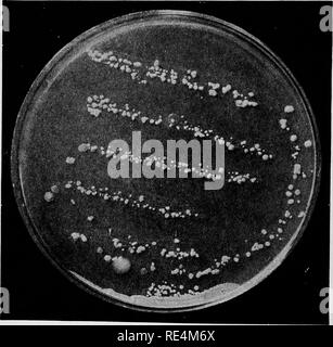 . Pharmaceutical batteriologia. Batteriologia; disinfezione e disinfettanti. 84 PHARMACEUTICAL batteriologia h. Bip cultura stab-dove la crescita è più attivo? Se nella parte inferiore, esso indica tendenze anaerobica. Se si limita alla sommità del mezzo, esso indi- cati decisamente tendenze aerobico. (La maggior parte dei batteri sono decisamente aerobica; che essi richiedono ossigeno libero per prosperare.) La provetta culture non rappresentano necessariamente le colture pure, e lo studente non è in grado di sapere se le crescite nelle provette rappresentano la predominanza della flora batterica nella sostanza da cui le vaccinazioni sono state effettuate. Th Foto Stock