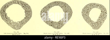 . Un contributo per l'istologia comparativo del femore. Femore; osso. MAN (razza bianca). Si prega di notare che queste immagini vengono estratte dalla pagina sottoposta a scansione di immagini che possono essere state migliorate digitalmente per la leggibilità - Colorazione e aspetto di queste illustrazioni potrebbero non perfettamente assomigliano al lavoro originale. Foote, James Stephen, 1851-1925; Hrdlicka, Ales, 1869-1943. Washington, Smithsonian Institution Foto Stock